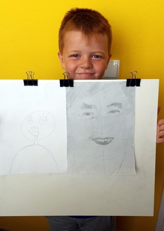 Vincent (10 éves) előtte utána